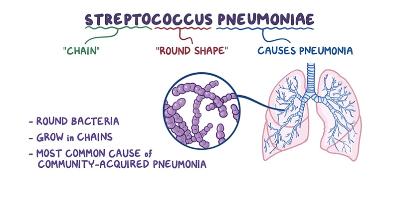 Streptococcus pneumoniae: Overview Video. 